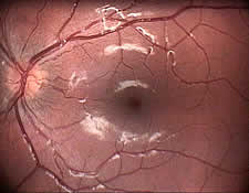 Foto des Augenhintergrundes